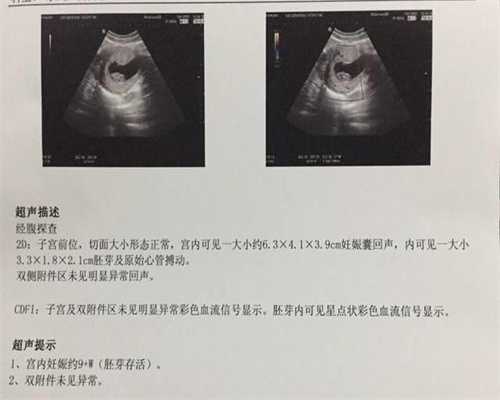 试管代孕代生宝宝-做试管代孕借卵子需要多少钱_马来西亚试管婴儿具体流程分